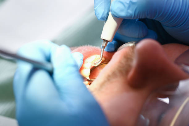 Best Dentist for Tooth Abscess  in North Haledon, NJ